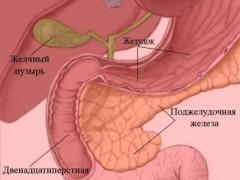 Острый дуоденит Острый дуоденит